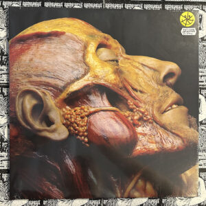 Lymphatic Phlegm - “Show-Off Cadavers - The Anatomy of Self Display” LP (Yellow splatter vinyl)