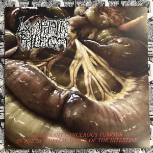 Lymphatic Phlegm / Flesh Grinder - “Malignant Cancerous Tumour in the Epithelial Tissue of the Intestine / From Rotten Process... to Splatter” LP (Black vinyl)